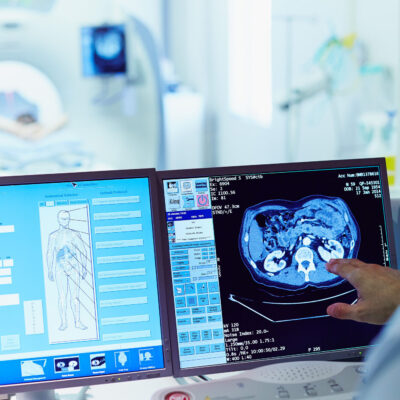 Radiologe, der in der Radiologie auf den PC schaut und mittels einer Software die Aufnahmen eines MRTs begutachtet